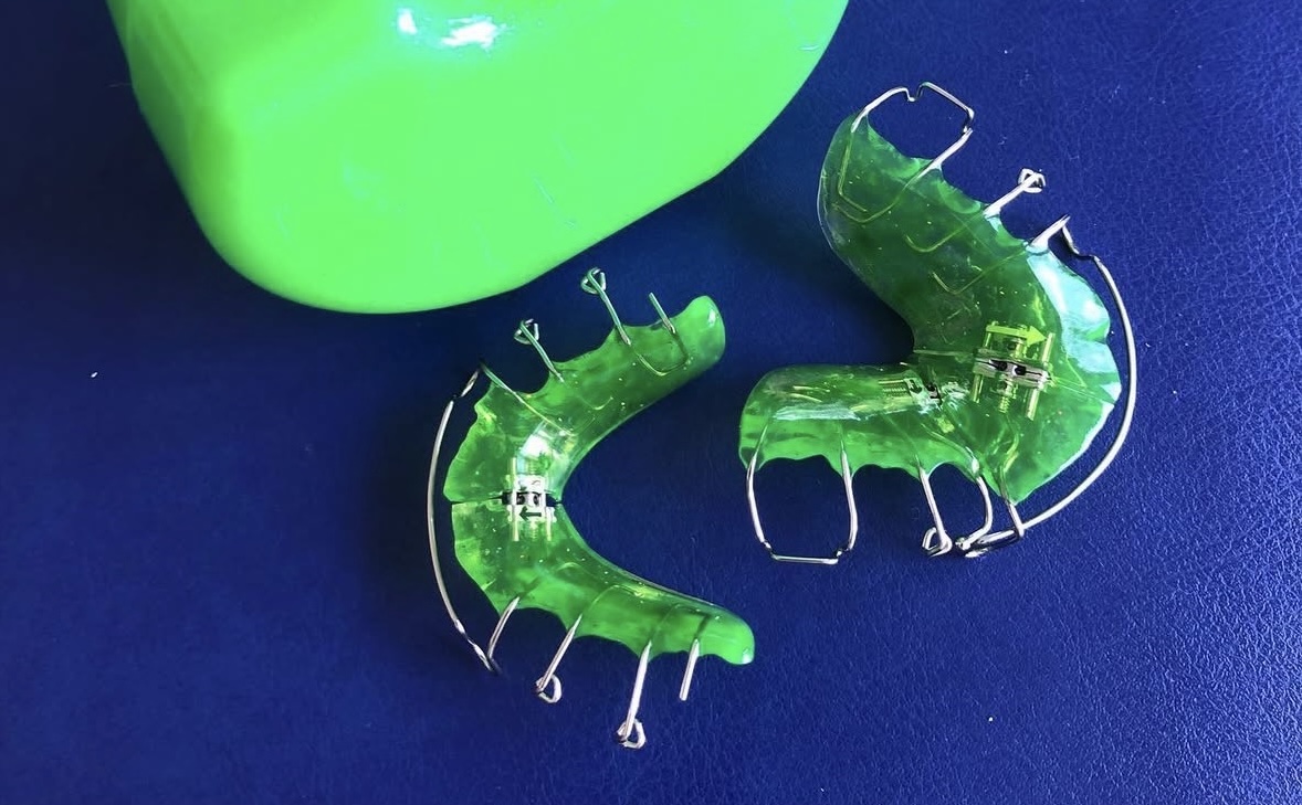 Kieferorthopädie Frühbehandlung